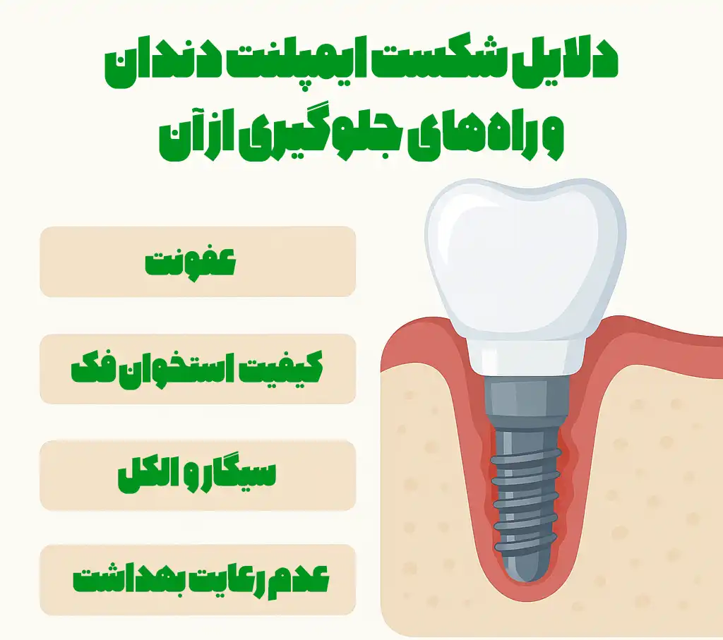 دلایل شکست ایمپلنت دندان