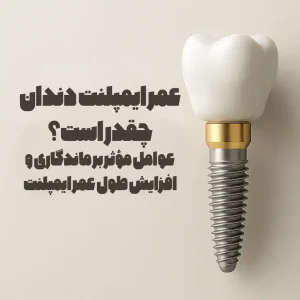 عمر ایمپلنت دندان چقدر است؟ عوامل مؤثر بر ماندگاری و افزایش طول عمر ایمپلنت