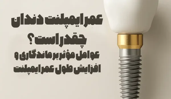 عمر ایمپلنت دندان چقدر است؟ عوامل مؤثر بر ماندگاری و افزایش طول عمر ایمپلنت